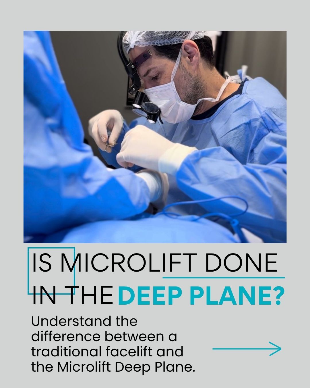 Is Microlift done in the Deep Plane? Understand the difference between a traditional facelift and the Microlift Deep Plane.